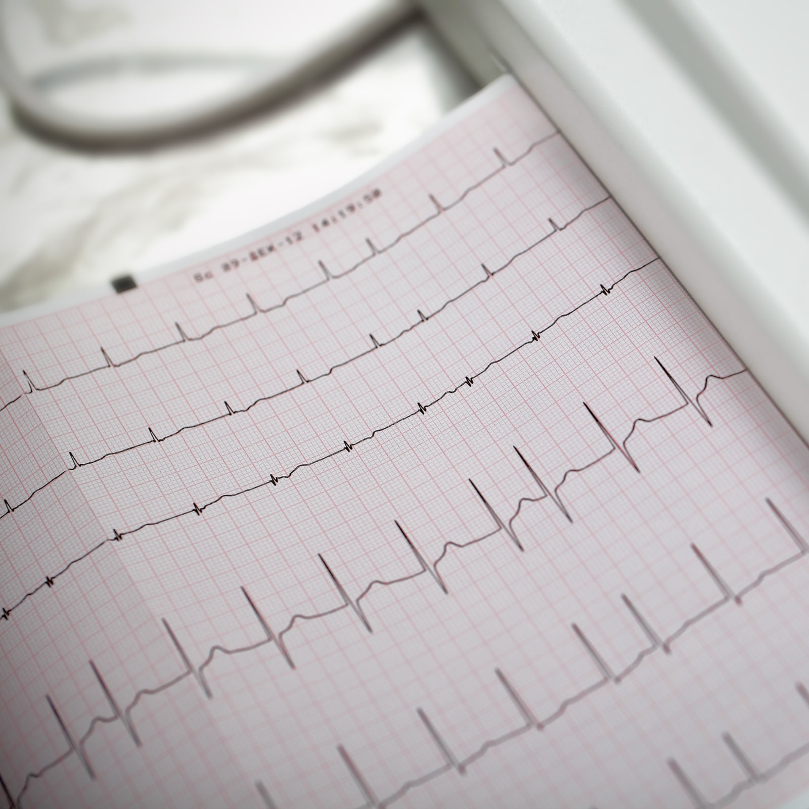 EKG readout